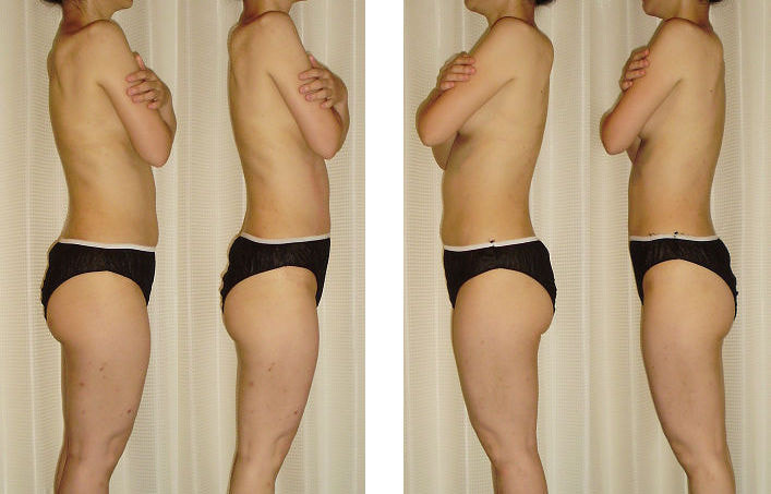 img20221122150312089294.jpg